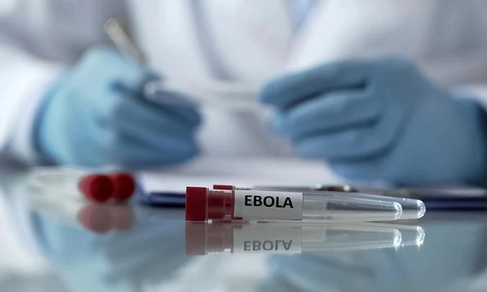 Τρία κρούσματα στη Βρετανία με τον αιμορραγικό πυρετό Lassa